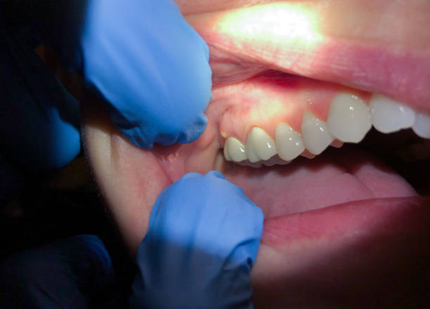 Best Root Canal Emergency Dentist  in Junction City, KS
