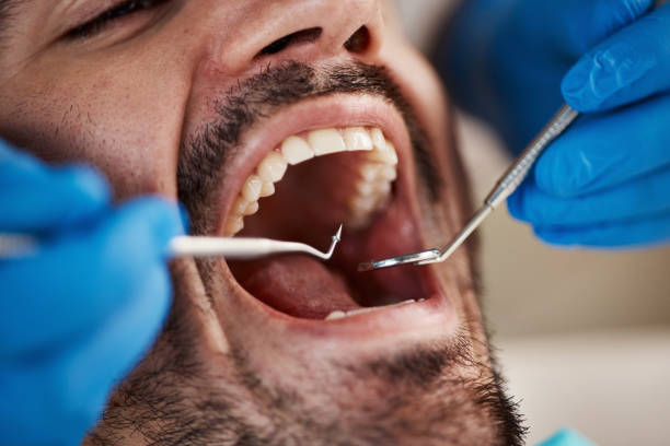Best Broken Tooth Emergency  in Junction City, KS